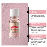 MEITREND Drying Lotion for Acne Treatment,Anti Acne Face Serum,Overnight Acne Drying Lotion,Spot Treatment,Pimple Lotio-n,Dry Out Blemishes & Pimple Reduce Redness