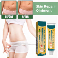 OuXing Wound Healing Oint-Ment,Relieve Skin Abrasions,Natral Healing Cream,Promote Skin HEA/ling Cream,Scab He/aling Cr/eam,Wo/und Cre/am Fade Scars,Wo/und He/aling Crea/m,Body Cre/am,WOU/nd Protection