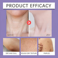 SingHao Neck Firming Stick,Firming & Lifting N/eck Cream,Neck Tightening Moisturizer Skin Care,Ne/ck Tightening C/ream,Anti-Wrinkte Sn/ake Oil Nec/k Care Stick,Wrinkle Cr/eam for N/eck,Smooths Neck Creams