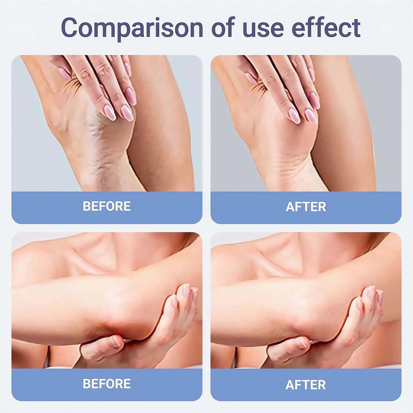 Urea Foot Cream 60 Percent- For Cracked Heels, Dry Skin Deep Moisturizing Lotion, Softens & Nourishes, Foot & Hand Cream Moisturizer for Women & Men 1PCS