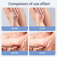 Urea Foot Cream 60 Percent- For Cracked Heels, Dry Skin Deep Moisturizing Lotion, Softens & Nourishes, Foot & Hand Cream Moisturizer for Women & Men 1PCS