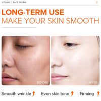 MrCuvaryas Vitamin C Moisturiser For Face Cream, Anti Aging & Wrinkle Day And Night Face Cream For Women & Men, Brighten & Even Skin Tone, Boost Skin Collagen, Reduce Fine Lines for Skin Care