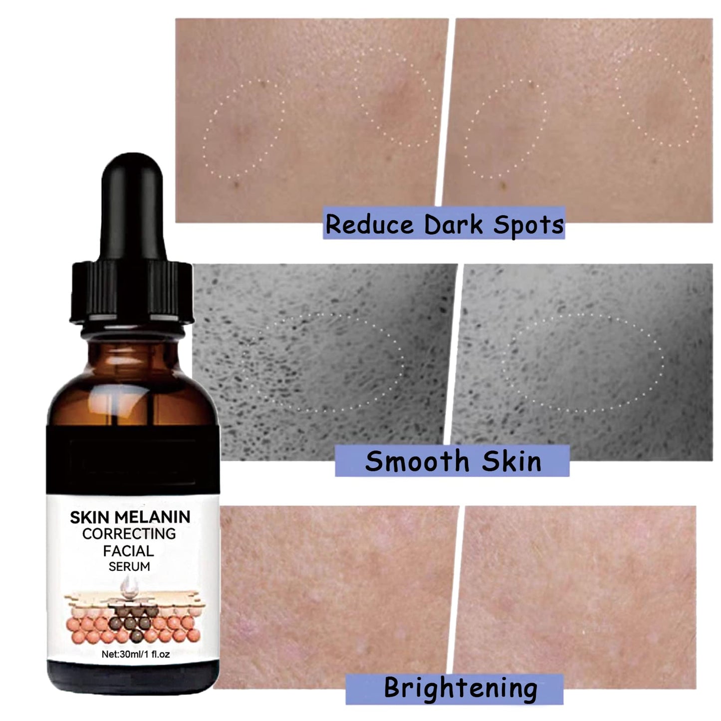 Dark Spots Correcting Facial Serum,2PCS Brightening Facial Serum,Rapid Dark Spot Correcting Serum,Improve Dry Skin & Smooth Skin,Brightening Serum,Dark Spot Remover Serum For Melanin Correcting