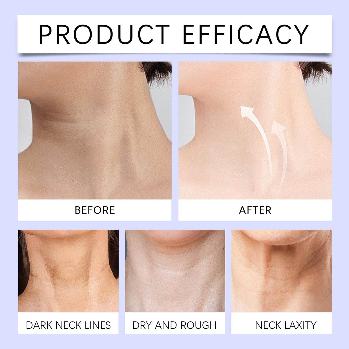 MEITREND Tighten & Lift Firming Neck Cream,2PCS neck firming cream,Anti Aging neck cream for sagging and tighten,Lifting Sagging Skin & Smooth Neck Wrinkle,Hydrating Neck Cream,Skincare Neck Cream-50ml*2