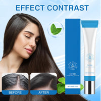 Benaewa 2 Pcs Hair Growth Serum, Scalp Refreshing Growth Serum, Care Ampoule for Hair Strengthen, Improve Scalp Health
