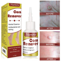 Corn Remover Wart Remover Corn Removal Corn Remover for Feet, Callus Remover, Cuticle Remover, Corn Remover Liquid to against Corn & Wart,15ml