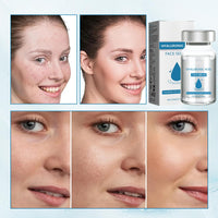 XdealCozyxc 6PCS Micro Infusion Kit, Facial System Serum Beauty Kit for Repair Skin Deep