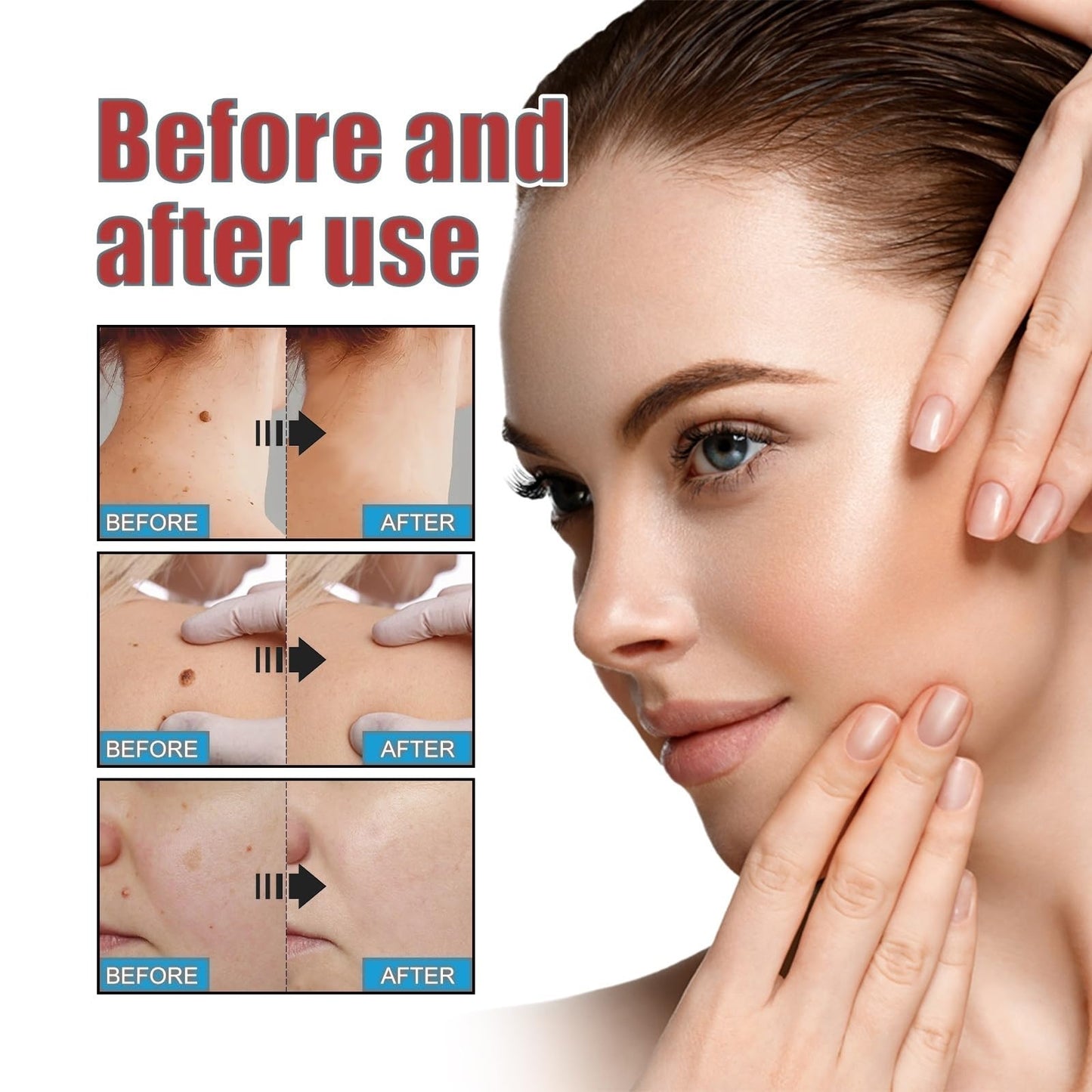 OuXing 288PCS T-ag'gone Patch,Spot Stickers,Nano Patch for Face and Skin,Face Care P/atch,Acne Pimple Patches,Skin T-ag Remover Patches,M-ole Remover,Skin Ta-g P/atches,Skin Ta-g R/emover,W-art Treatment