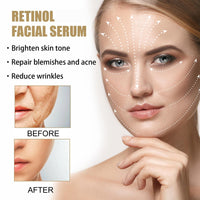 QinZiEn Retinol Revive Eye Cream,Anti Wrinkle Retinol Serum for Face,Anti Aging Retin-ol Cream for Neck,Dark Circles Under Eye Reti-nol Eye Cream,Face Serum Eye Bags Remover,Wrinkle Filler,F-ace Moisturisers