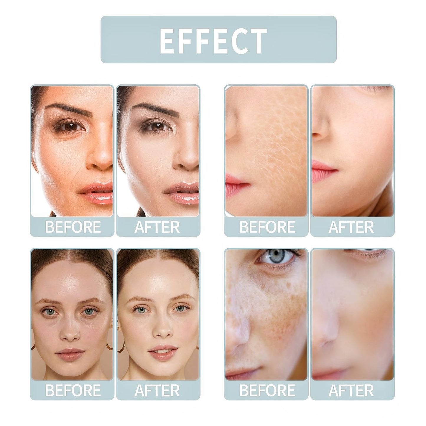 QinZiEn Total Package Serums,Hyaluronic Acid Serum,Hydrating Serum,Face Moisturisers,Collagen Ser-um for Face,Hyaluronic Acid Moisturiser,Anti Wrinkle Ser-um,Anti Aging Se-rum,Moist-uriser for Dry Skin Fac-e