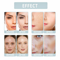 QinZiEn Total Package Serums,Hyaluronic Acid Serum,Hydrating Serum,Face Moisturisers,Collagen Ser-um for Face,Hyaluronic Acid Moisturiser,Anti Wrinkle Ser-um,Anti Aging Se-rum,Moist-uriser for Dry Skin Fac-e
