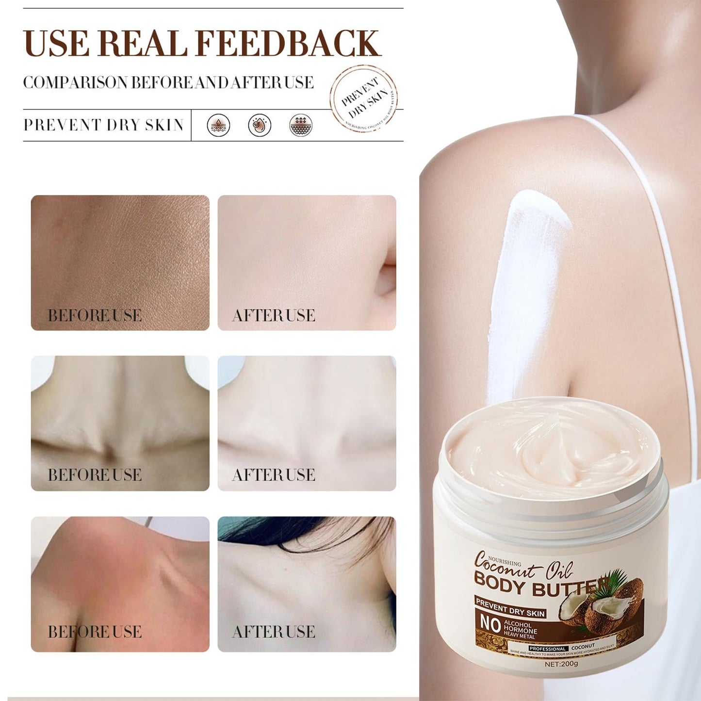 Coconut Body Butter 200g – Intense Moisturizer for Dry Skin, Enriched with Coconut Oil. Deeply Nourishes, Soothes, and Hydrates for Silky Smooth Skin. Daily Skin Care Routine