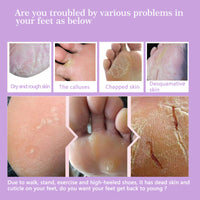 Tongyend Foot Peel Mask,3Pcs Natural Aloe Vera Gel Foot Mask,Foot Peel Mask For Hard Skin,Exfoliating Feet Peeling Socks,Foot Callus Remover,Foot Care,Feet Hard Skin Remover,Pedicure Sets For Feet (Lavender)