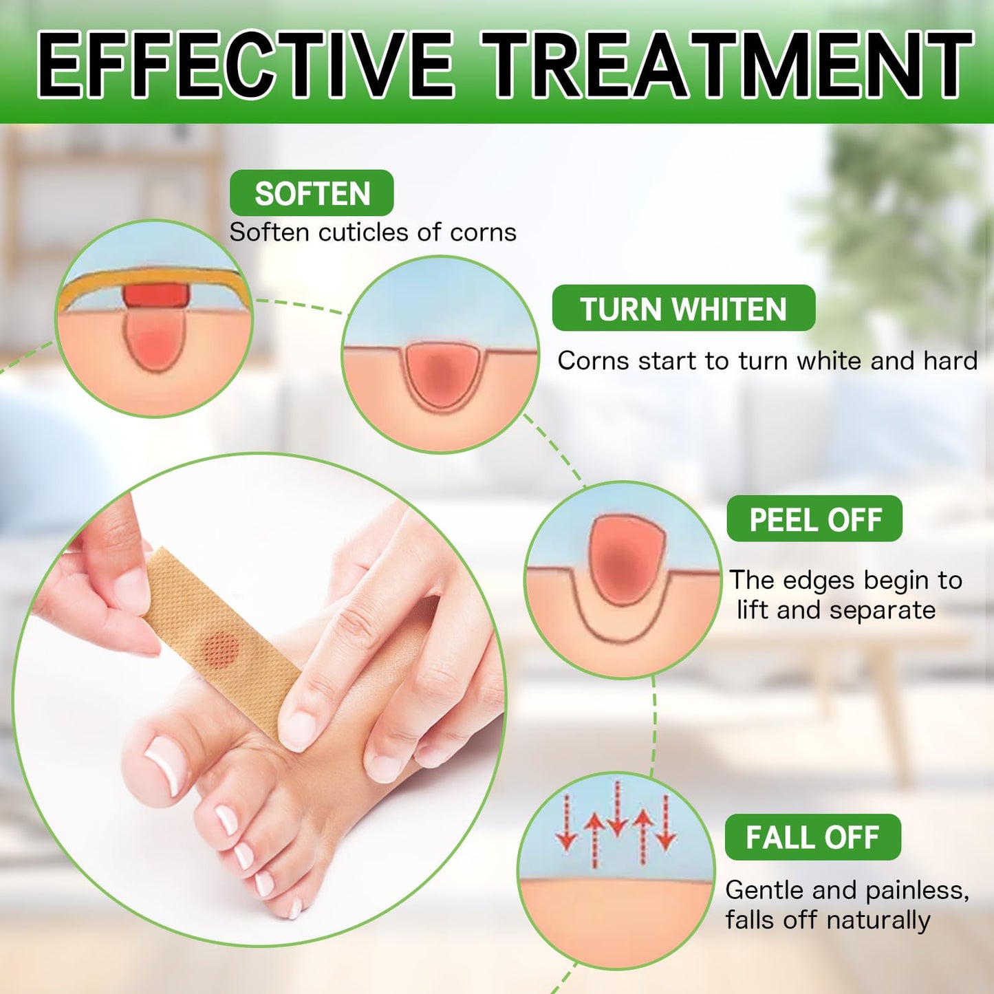 Soneat Wart Remover, 30pcs Verruca Treatment, Plantar Wart Remover for Hands, Feet, Effective Deep Verruca Removal Pads Patches