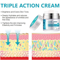 SingHao Dark Spot Remover for Face&Body,Dark Spot Correcting Cream,Dar/k Sp/ot Remover,Pigmentation Removal,Da/rk Spo/t Corrector Cream,Freckle Removel Crea/m,Hyperpigmentation Treatment Mela-Sma Cr/eam