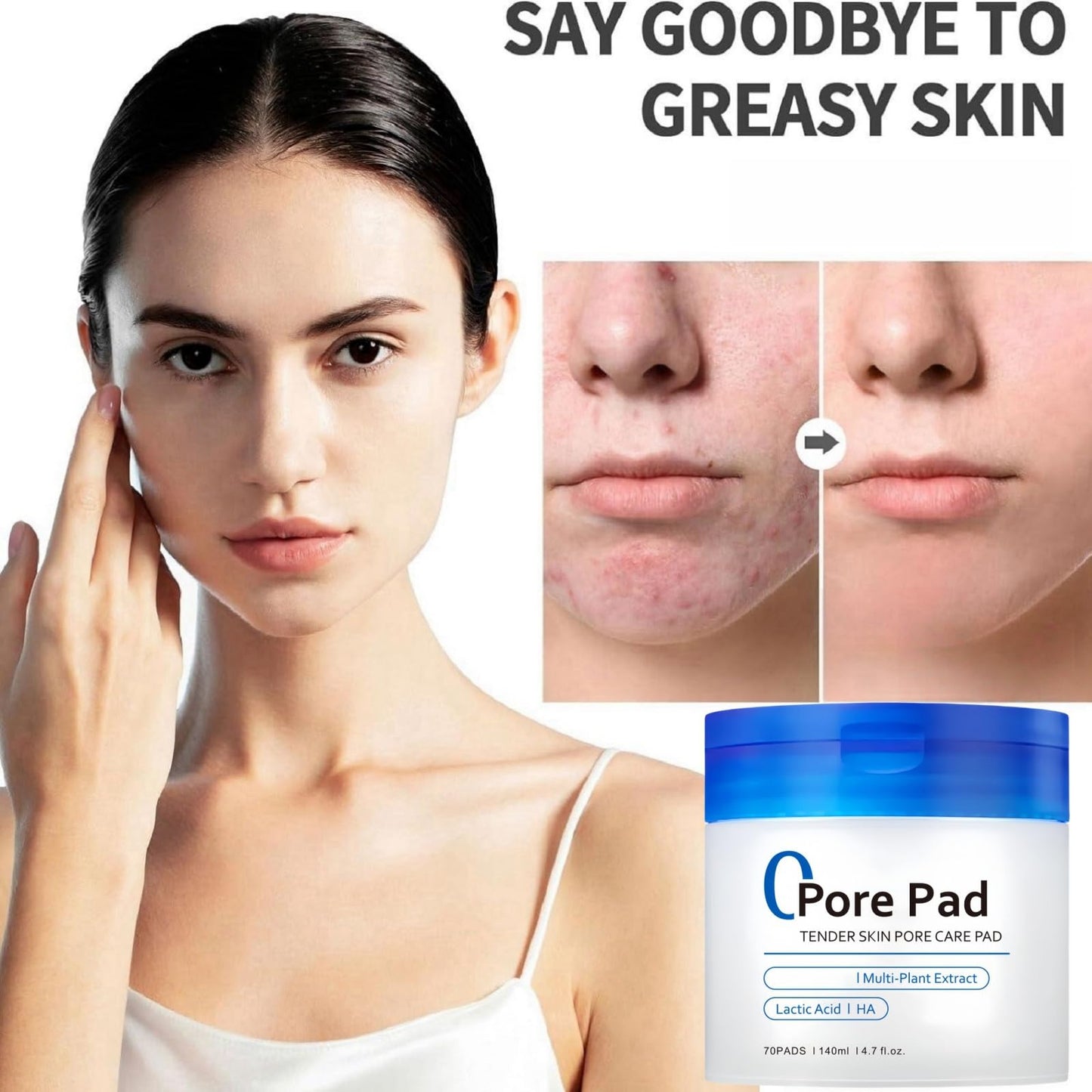 Ruojiar 70 Pads Zero Pore Pads,Dual-Textured Facial Toner Pa/ds for Exfoliation and Minimizing Pores,Face Cleansing Pa/ds,Shrink Po/res Facial Exfoliating P/ad,Korean Skin Care,Gentle Exfoliator Face