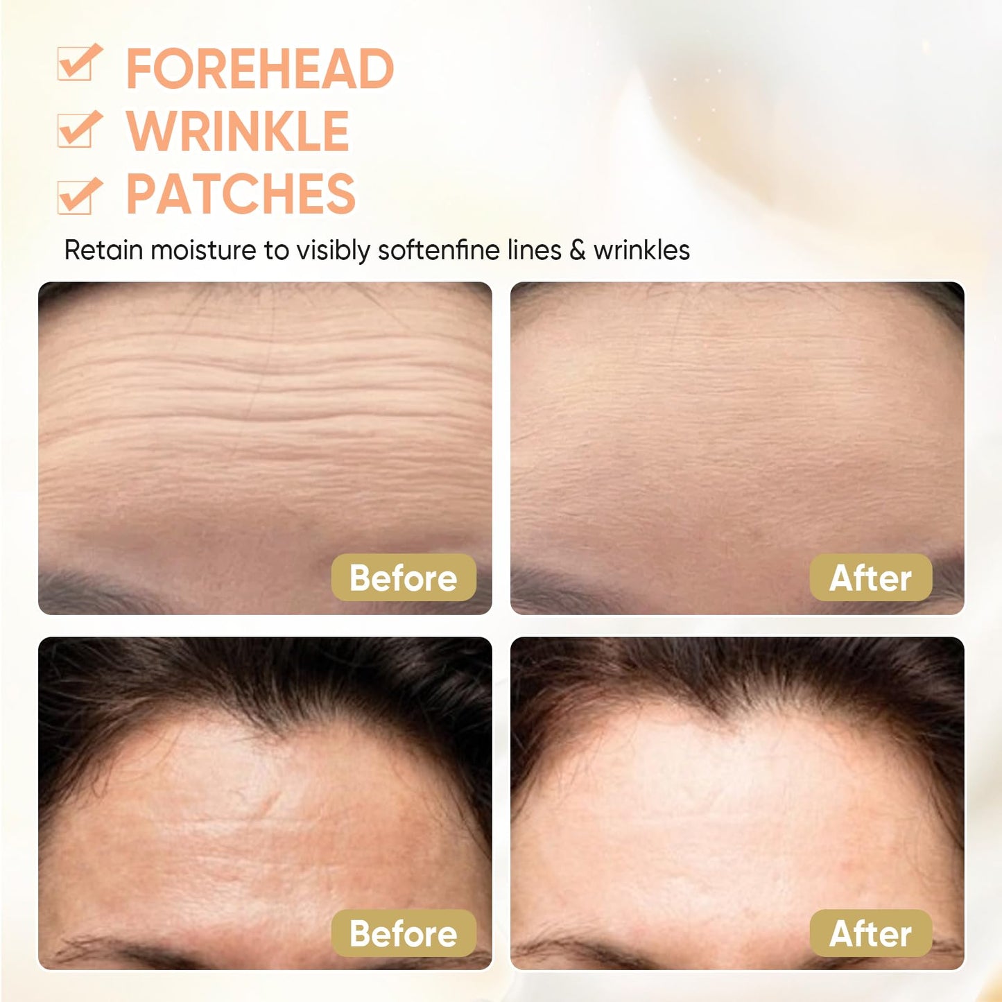 InfiniteRelax Forehead Wrinkle Patches For Anti-wrinkle, Anti Aging Facial Mask For Women Face Lift - with Aloe, Collagen, Vitamin E Overnight Sleep Tape For Wrinkles 12 Pcs