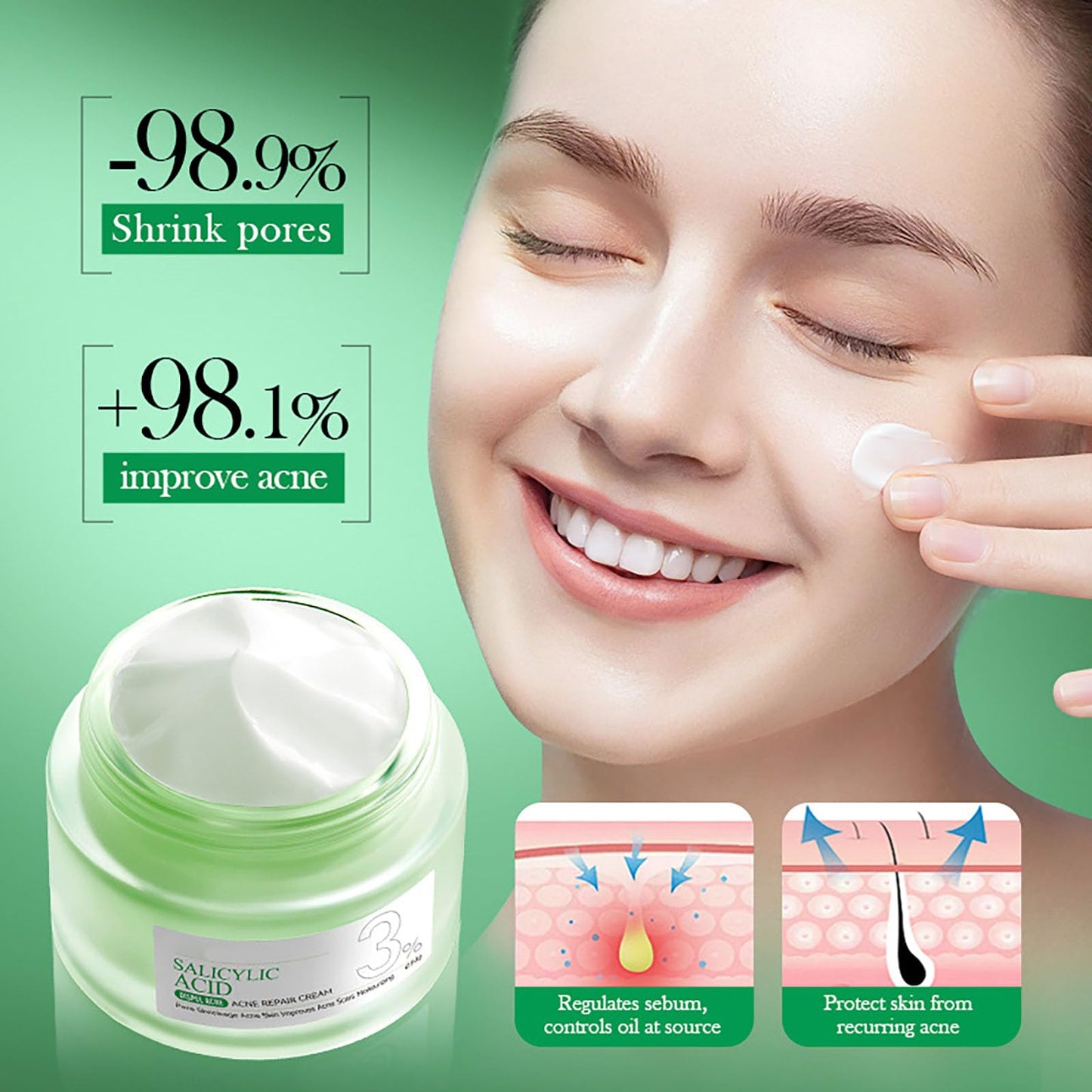 ISBEAUSOLS Salicylic Acid Acne Cream 50g - 3% BHA Spot Cream for Acne - Blackhead Remover - Dark Spot Remover for Face - Scar Removal Cream - Moisturizing Face Cream for Women - Pimple Cream for Redness