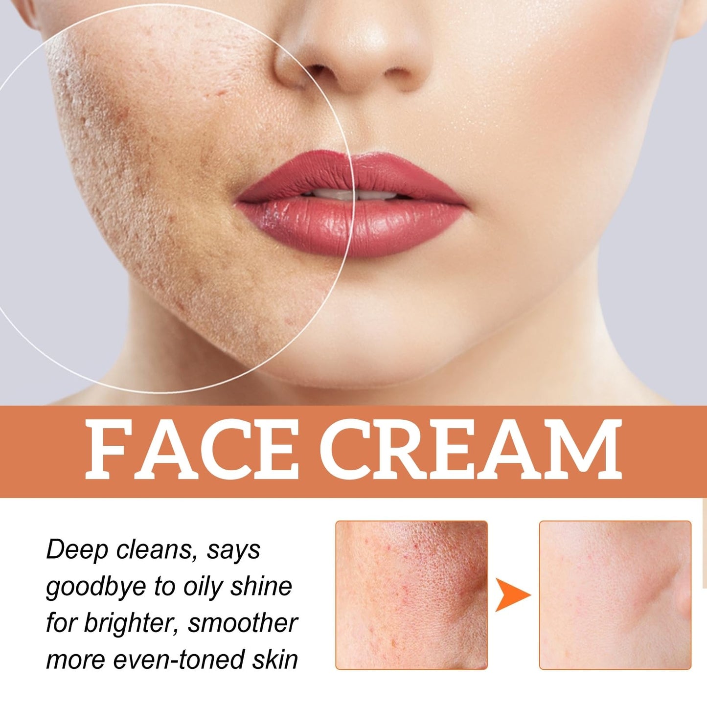 OuXing Spot Cream,Spot Treatment,Spot Remover,Spot Treatment for Face,Cream for Dark Skin Treatment,Anti Aging Face Cream,Spot Remover for Face,Freckle Removal Cream,Spot Corrector,Age Spot Remover for Face