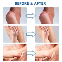 ISBEAUSOLS Urea Cream 60 Percent for Feet - Urea Foot Cream - Foot Cream for Cracked Heels and Dry Skin - Cracked Heel Repair Cream - Skin Care Hands & Feet - Foot Moisturiser 2PCS