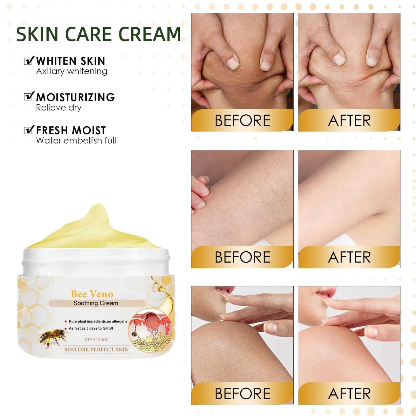 Bee Ve-nom Cream,Bee V-enom Treatment Cream,Professional Bee V-enom Repair Cream,Natural Moisturizing Cream for All Parts of The Body,Soothing Bee V-enom Removal Cream,Fast-Acting Bee Ve-nom Cream