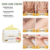 Bee Ve-nom Cream,Bee V-enom Treatment Cream,Professional Bee V-enom Repair Cream,Natural Moisturizing Cream for All Parts of The Body,Soothing Bee V-enom Removal Cream,Fast-Acting Bee Ve-nom Cream