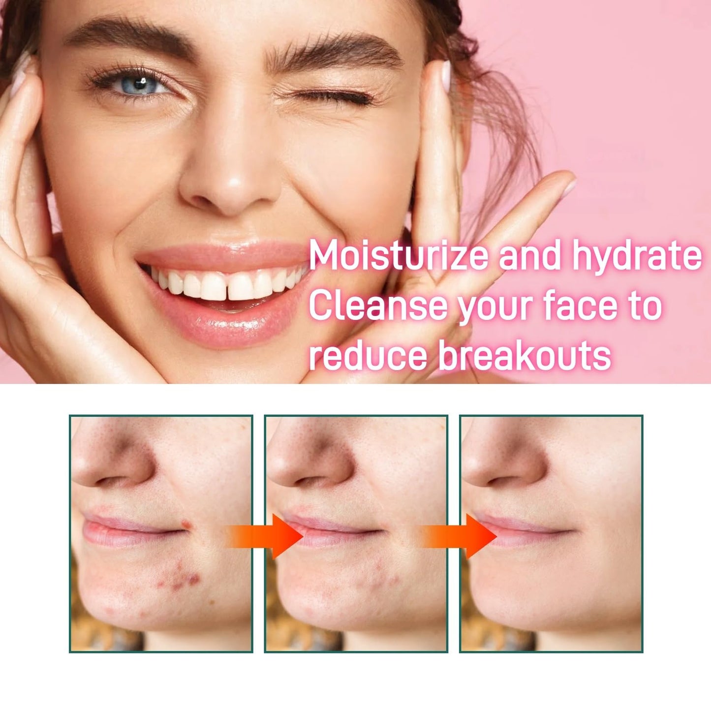 Oumun 15% Acid Acne Treatment Gel,Anti Acne Face Cream,Face Acne Treatment,Acid 15% Facial Serum Cream,Spot Treatment,Gentle Acne Cream,Spot Serum Cream for Face,Pimple Treatment Gel Cream,Face Gel for Acne