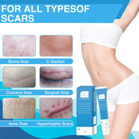 COWANIEE 2 Pcs Scar Removal Cream,20g