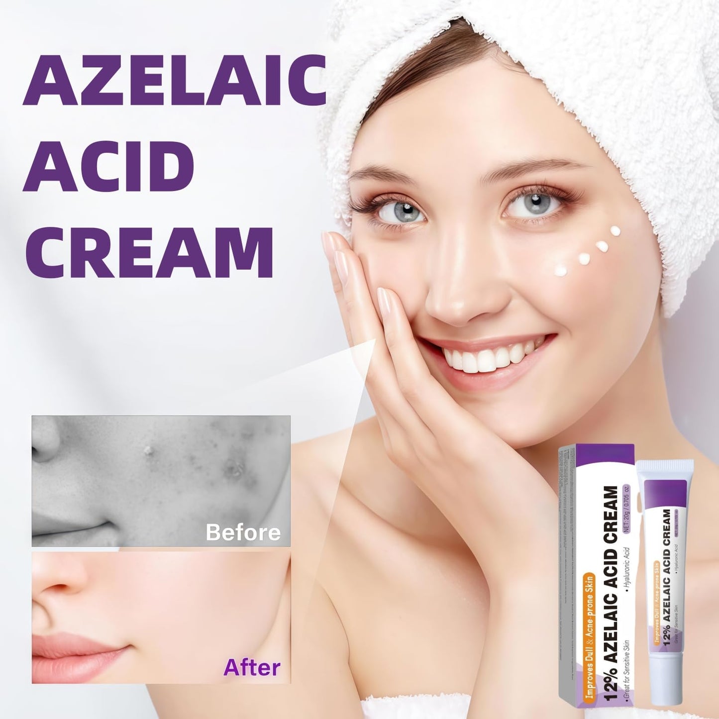 Fankayi Azelaic Acid Serum Cream,Face Hyaluronic Acid for Redness & Dark Spots,Brightening Face Skin Care Treatment,Dark Spot Remover,Brightening Serum,Whitening Freckle Cream,Dark Spot Correcting Serum