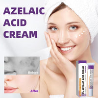 Fankayi Azelaic Acid Serum Cream,Face Hyaluronic Acid for Redness & Dark Spots,Brightening Face Skin Care Treatment,Dark Spot Remover,Brightening Serum,Whitening Freckle Cream,Dark Spot Correcting Serum
