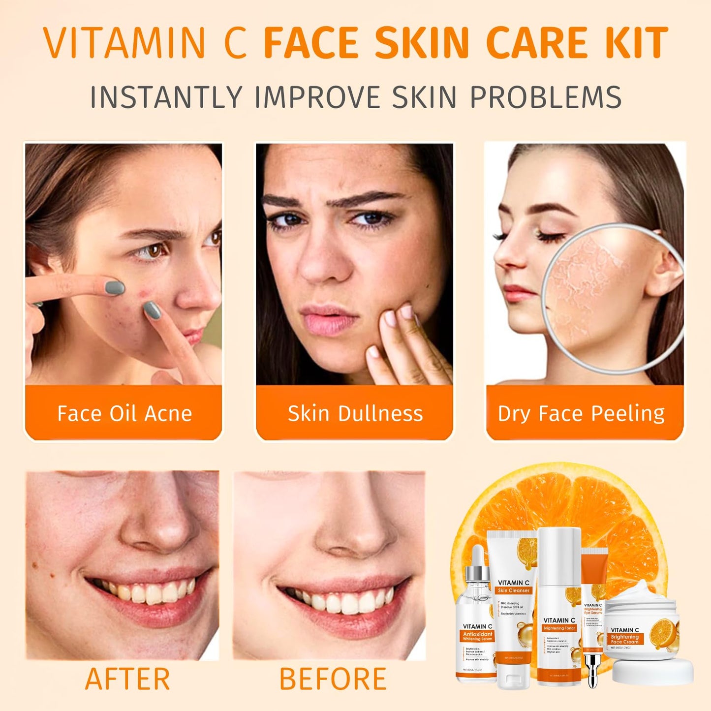 IZBEAUVO Skin Care Sets For Teenagers, Vitamin C Skincare Set, Teenage Girls Gifts - 5 Piece Gentle Skin Cleaning & Care Facial Kit With Cleanser, Toner, Serum, Eye Cream, Face Cream, Moisturise & Brighten