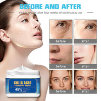 IZBEAUVO Kojic Acid Cream,Kojic Acid Dark Spot Remover For Face Body Moisturiser Firming Cream,Skin Lightening Cream For Dark Skin with Kojic Acid | Vitamin C & E |Niacinamide | Collagen Repair Barrier