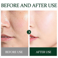 NatrLuxe Tea Tree Zits Cream 50g - Cream With Oil Control, Soothing & Moisturizing - Improve Zits & Blemishes - Clearer Skin Solution