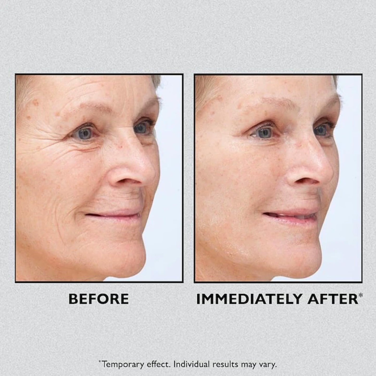 Instant Firmx Temporary Face Tightener, Skin Tightening Cream For Face, Face Tightening Cream, Anti Wrinkle Face Cream For Mature Skin, Firm & Smooth The Look Of Fine Lines, Reduces Sag & Dull