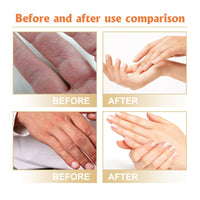 1PCS,Retinol Hand Cream,Retinol Anti-Aging Hand Cream,Intense Moisture Ha/nd Cre/am,H/and Crea/m for Very Dry Han/ds,Anti Aging H/and Cre/am,Han/d Repair Cr/eam,Intense Ha/nd C/ream
