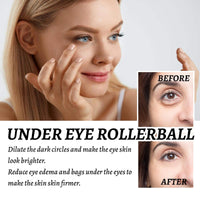 Rollerball Castor Oil,Castor Oil and Frankincense Eye Roller,Castor Oil Eye Roller Serum,Eye Cream for Dark Circles and Puffy Eyes,Eye Cream Anti Aging Skincare,Eye Bags Remover,Firming Eye Cream