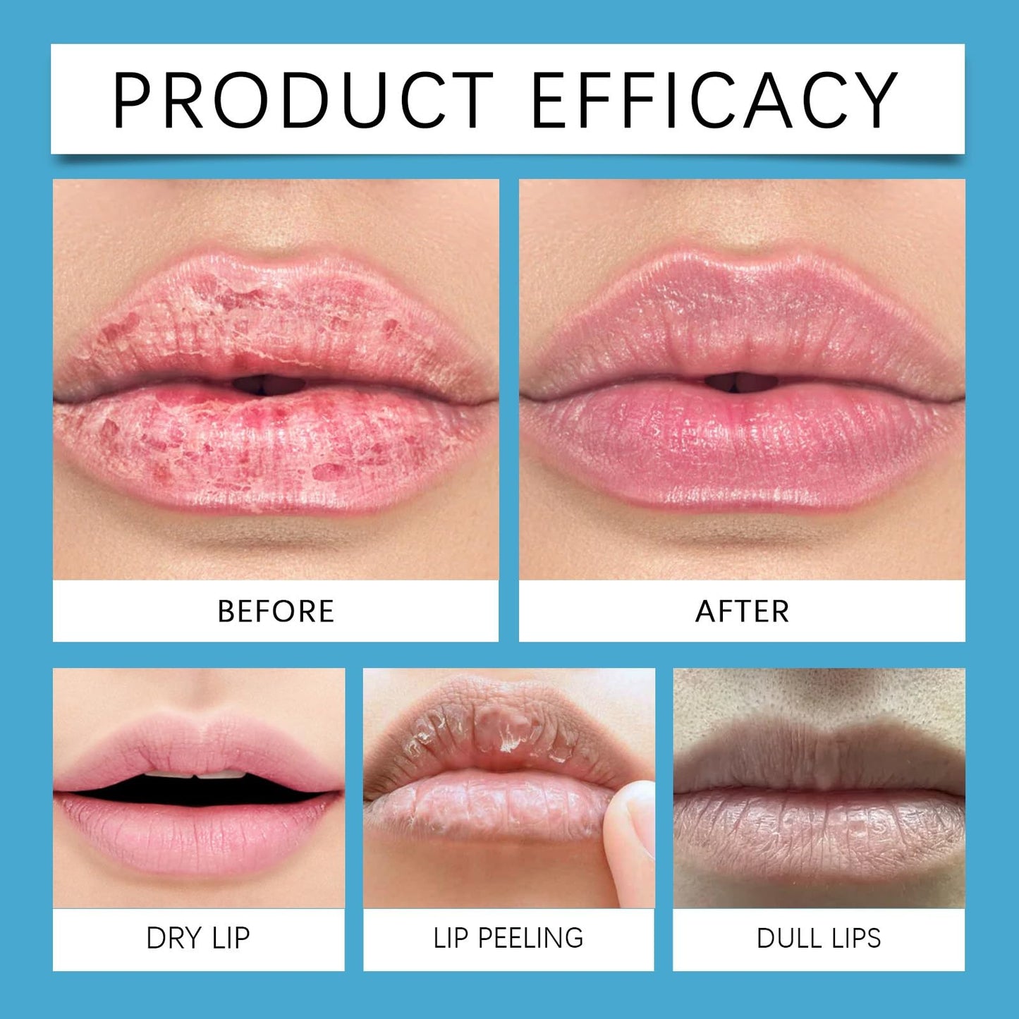 Xunzhi Spicule Plumping Lip Shot,Lip Plumper Extreme,L/ip Plump Lipstick,Liquid Microneedling Plumper Enhancer,L/ip Plumping Serum,Nourishing Li/p Serum Plump,Moisturizing Li/p Oil,P/lumping L-ip Oil,4ml