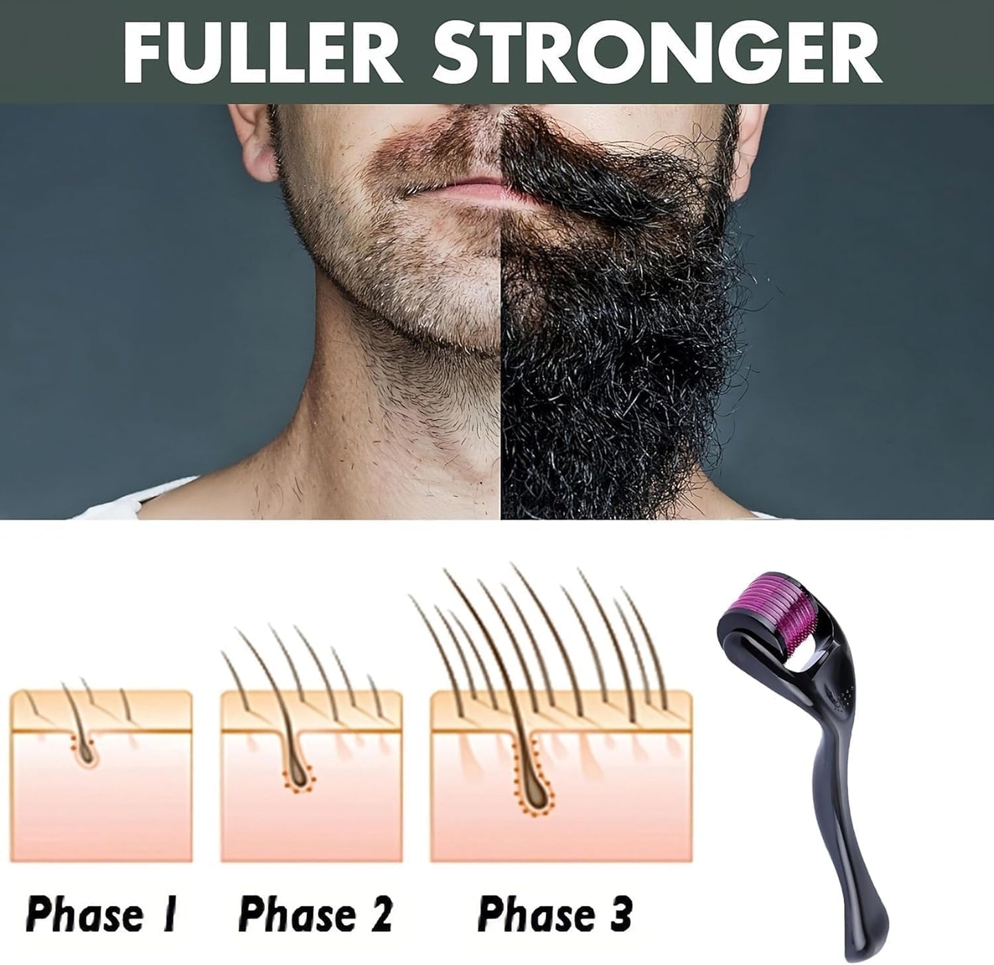Derma Roller for Skin,Beard Derma Roller for Hair Growth & Care,Facial Roll, Micro needling 0.25mm 0.5mm 1mm 1.5mm,540 Titanium Micro Needles for Facial,Body & Hair Growth (0.5MM)