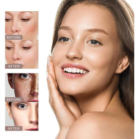 QinZiEn Anti-Hyperpigmentation Cream,Cream for Hyperpigmentation Treatment,Anti Aging Face Cre/am,Moisturiser Face Women,Dark Spot Remover,Wrinkle Filler Face Moisturiser,Intense Face Moisturiser 30g