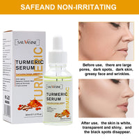 SUNDEER Turmeric Dark Spot Corrector Serum, Turmeric Repair face care Face Serum, Bright Skin Moisturizing Repair Whitening Serum for Face, 2022 New Organic Skin Lightener (1PC)