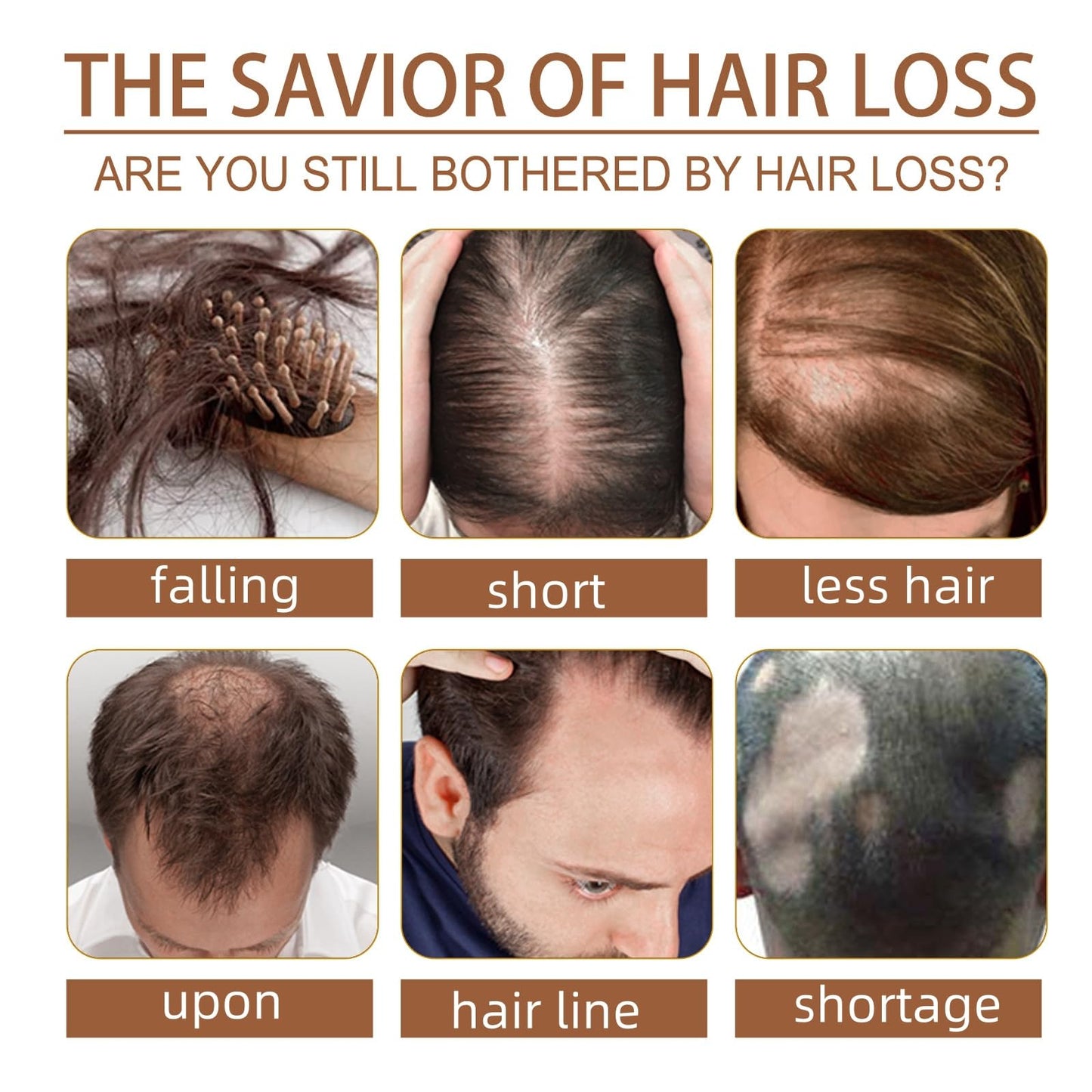 Oumun Powder for Hair Growth,Hair Loss Treatment for Women,Fast Ha-ir Growth Essence,Ha-ir Serum for Hai-r Growth,Natural Herbal Health H-air Loss Makes Growth,H-air Fall Treatment for Women