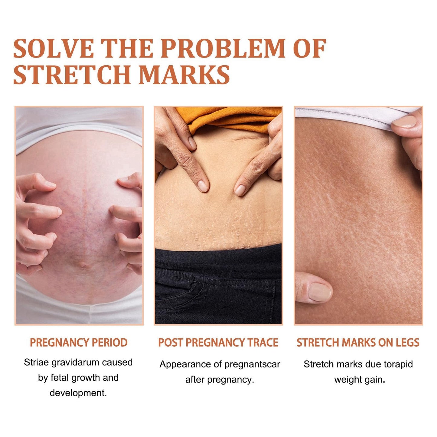 HIVETZ 125ml Optimal Oil,Collagen Boost Firming Lifting Skincare Oil,Skin Regenerate Oil,Body Oil for Women,Stretch Mark Oil,Stretch Marks Removal,Body Skin Care Improves Appearance of Stretch Marks