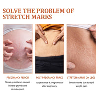 HIVETZ 125ml Optimal Oil,Collagen Boost Firming Lifting Skincare Oil,Skin Regenerate Oil,Body Oil for Women,Stretch Mark Oil,Stretch Marks Removal,Body Skin Care Improves Appearance of Stretch Marks