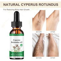 Cyprus Oil for Hair Removal,2PCS Natural Cyperus Rotundus Oil,Body Oils for Hair Removal,Soothing Reduce Hair & Moisturizes,Easy to Removal Body Hair & Hydrating,Cyperus Rotundus (60ML/2PACK)