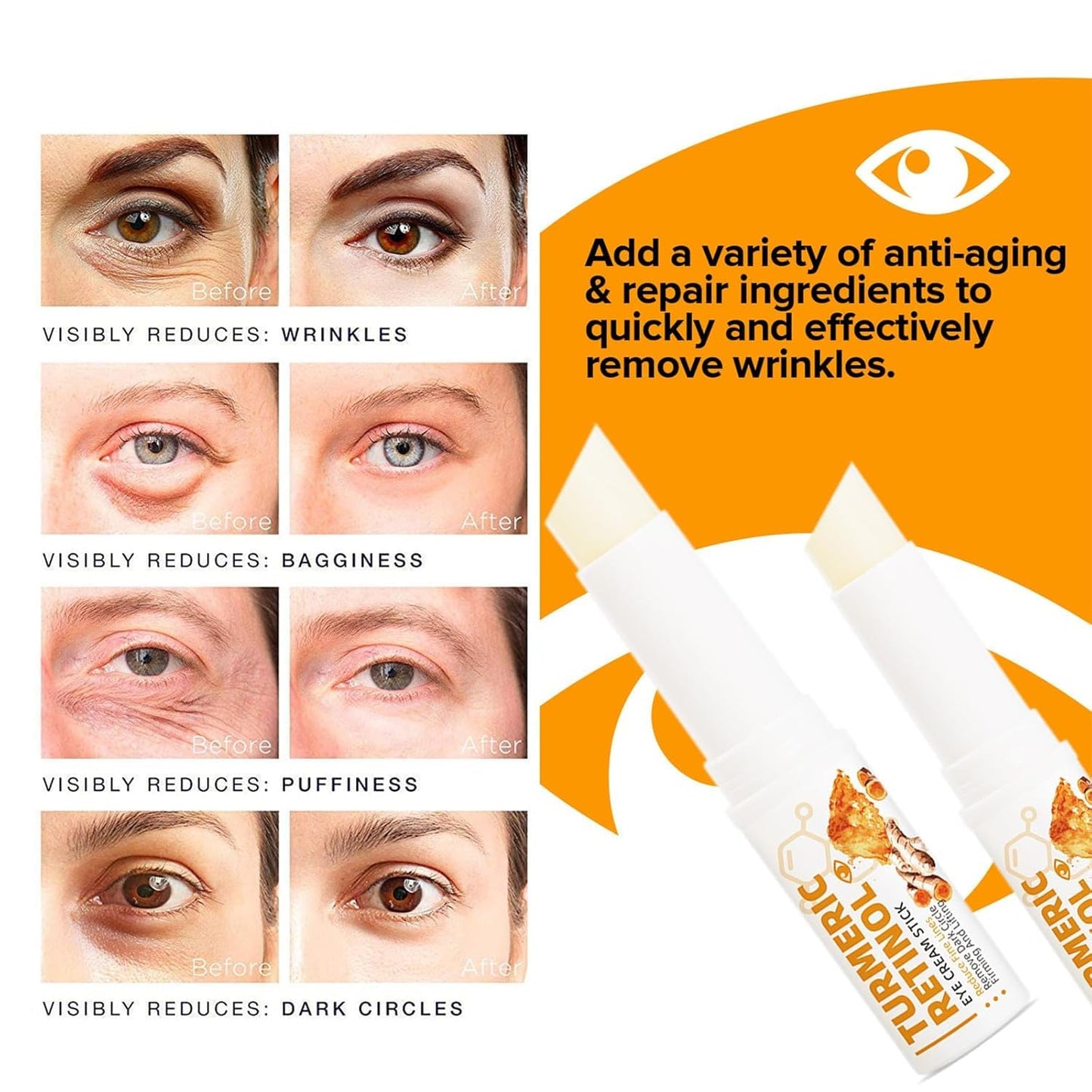 agctrler 2 Pieces Turmeric Eye Cream Stick, Turmeric Retinol Eye Balm Pen, Retinol Eye Cream, for Dark Circles and Wrinkles, Reduces Puffiness, Fine Lines and Eye Bags, for All Skin Types