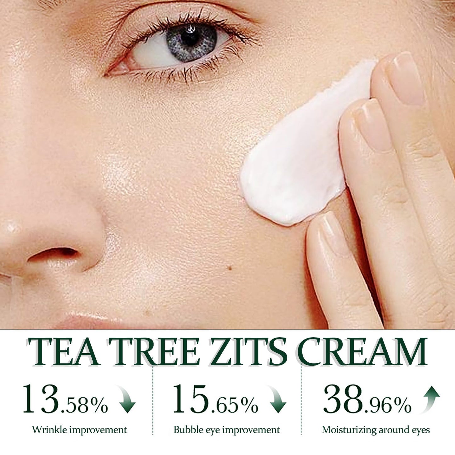NatrLuxe Tea Tree Zits Cream 50g - Cream With Oil Control, Soothing & Moisturizing - Improve Zits & Blemishes - Clearer Skin Solution