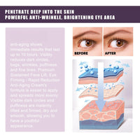Electric Eye Cream,Eye Cream for Dark Circles and Puffy Eyes,Organic Eye Repair Cream,E-ye Bags Remover,Ey-e Cre-am for Wrinkles,Firming Ey-e Cr-eam,E-ye Serum for Dark Circles,Eyecare Products