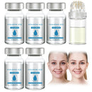 XdealCozyxc 6PCS Micro Infusion Kit, Facial System Serum Beauty Kit for Repair Skin Deep
