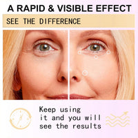 Ruojiar Eye Cream for Dark Circles and Puffy Eyes,Anti Wrinkle Eye Cream,Snail Peptide Energetic Eye Roll-On,Under Eye Roller Cream,Hydrating and Firming Eye Serum Creams,Eye Repair Cream,Eye Bags Remover
