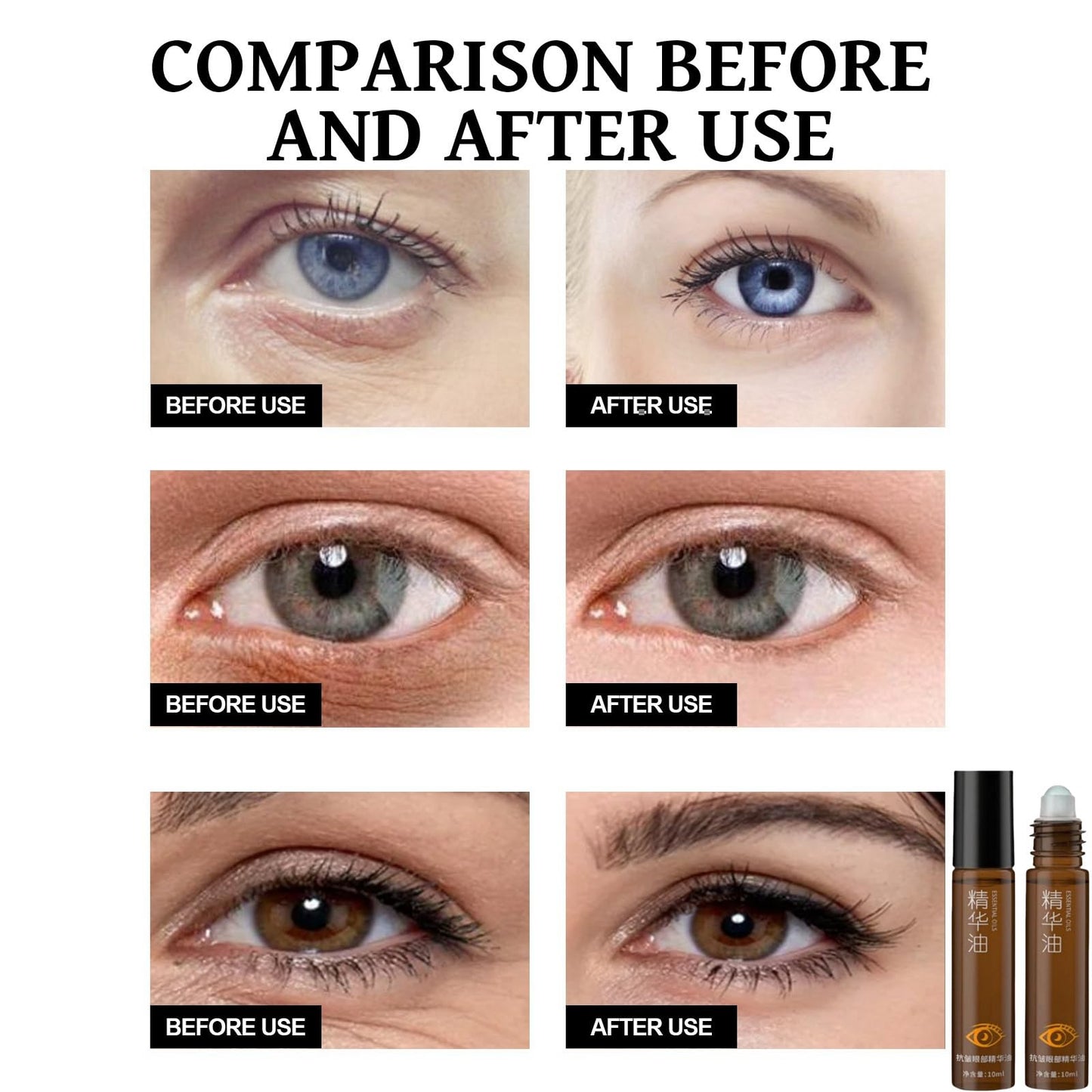 Jinjiar Rollerball Castor Oil,Roller Ball Essential Oil for Eye,Castor Oil and Frankin-Cense Eye Roller,Eye Cream for Dark Circles and Puffy Eyes,Under Eye Cream,Eye Bags Remover,Eye Cream Anti Aging,Eye Gel